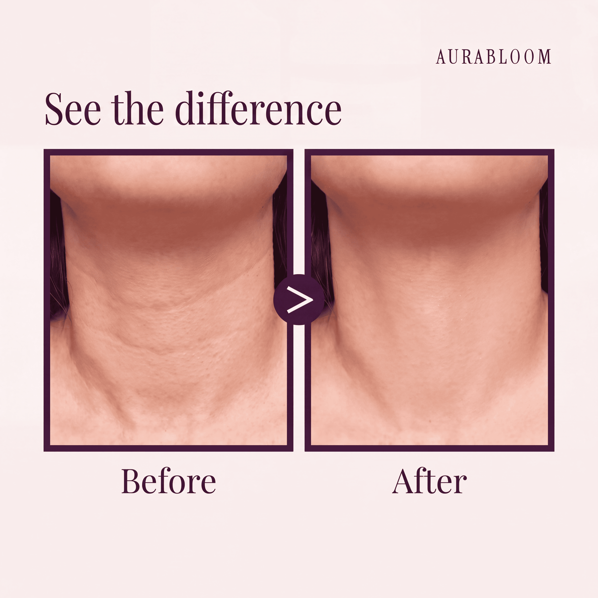 PDRN Collagen Gua Sha Neck Cream